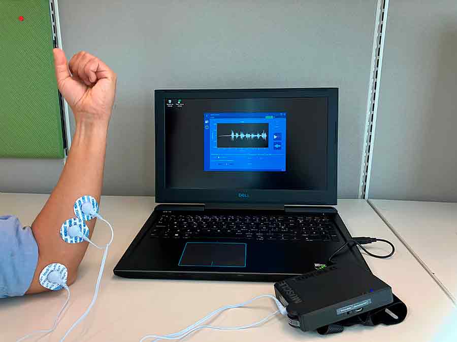 MioTracke dispositivo monitorizar rehabilitación